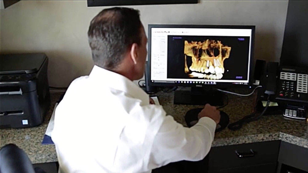 Dental Implant Procedure Hillsborough New Jersey NJ